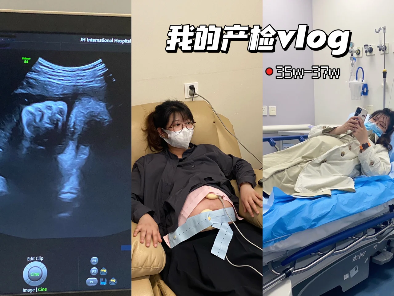 吐血整理/最详细的产检时间表快拿小本记好