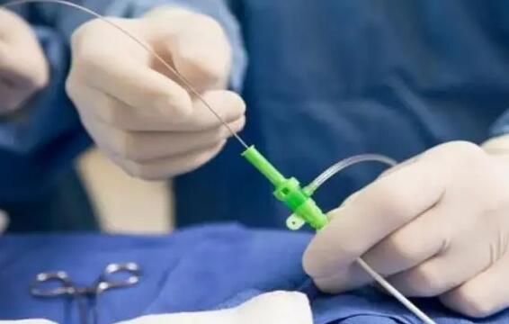 杭州代生中介靠谱吗 在杭州妇保做试管成功率的高的人群： ‘用酒精测试男女图片’