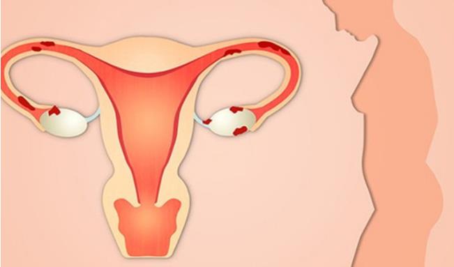 试管婴儿费用可以刷医?？?？如何降低试管婴儿费用？