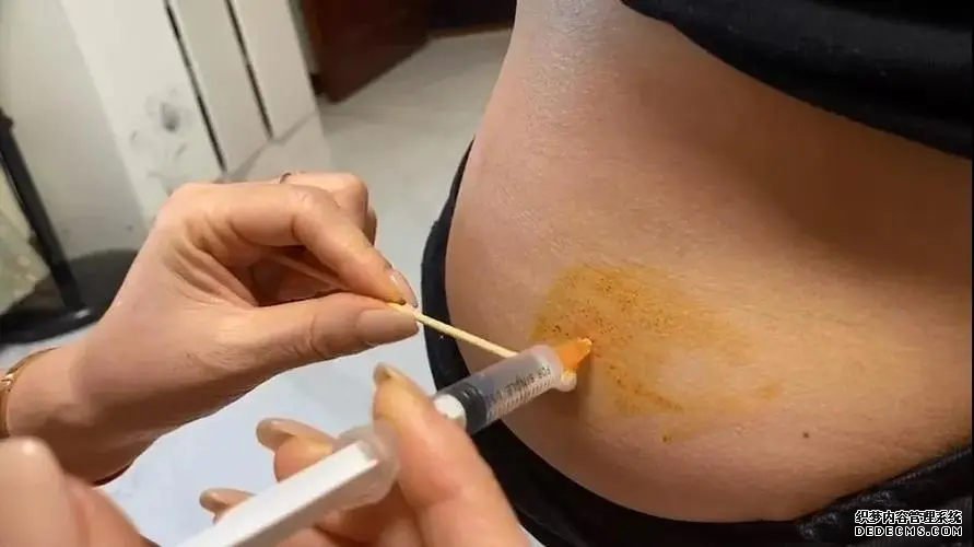 重庆供卵试管过程需要多久 2022年重庆十大试管医院排名榜 ‘孕囊3.64*3.98*0.98是男是女’