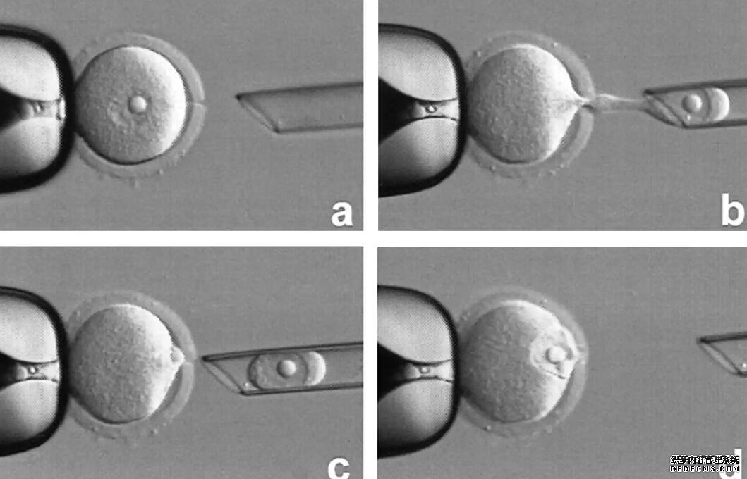 杭州供卵试管资讯 杭州不孕不育的医生推荐。 ‘用浓度为95%的酒精测男女,怎么测最准确?’