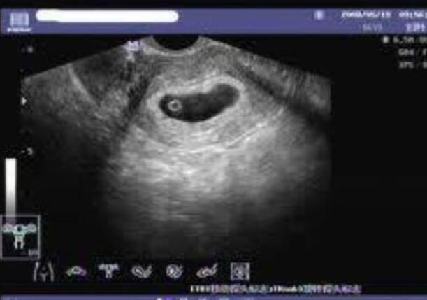 大连试管供卵 大连生殖中心试管婴儿：怎样才能做试管婴儿成功？ ‘做四维看见宝宝有尿男孩女孩’