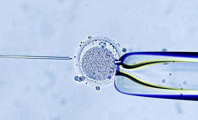 四川省医院 试管 四川攀枝花成首个发放生育补贴的城市 ‘孕囊4.2*3.9是男孩还是女孩’