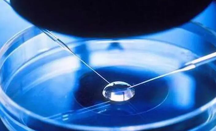 男性精子活力低，美国试管婴儿方案?成功率有多大?