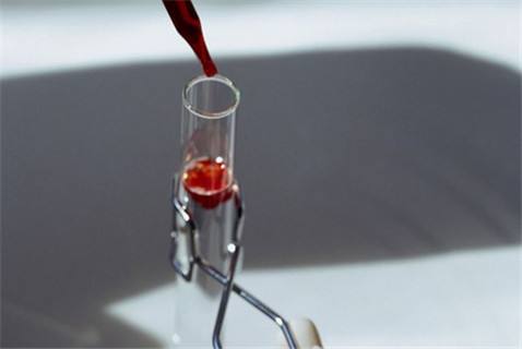 广西试管供卵 广西壮族自治区妇幼保健院可以做几代试管婴儿? ‘营口伊人26周四维看男女准么’