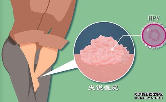 试管短方案提高试管移植成功率的方法有哪些？