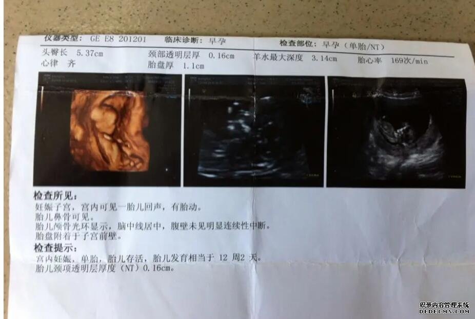 种植窗检查有必要吗,种植窗的检查有几种方法