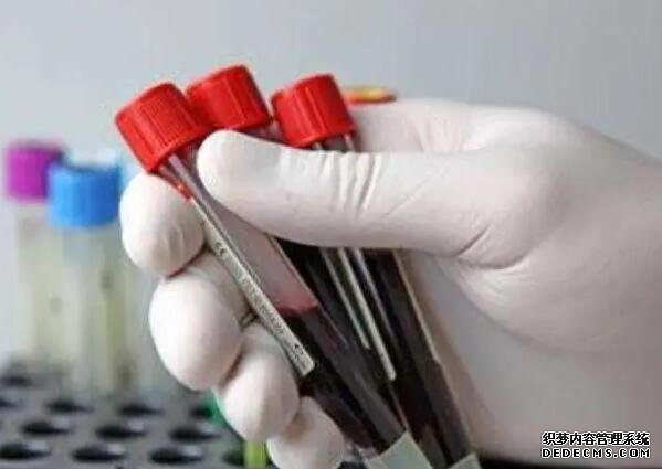 孕妇做梦梦到猪是不是说明一定是生女孩?为什么?