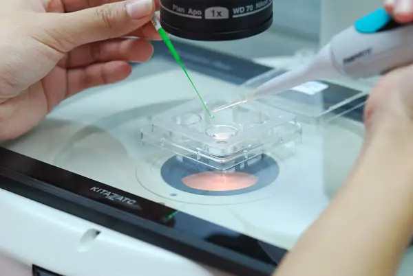 第三代试管 深圳 深圳试管婴儿中心医院的医生技术好吗？ ‘孕囊35×38x25是男孩还是女孩’