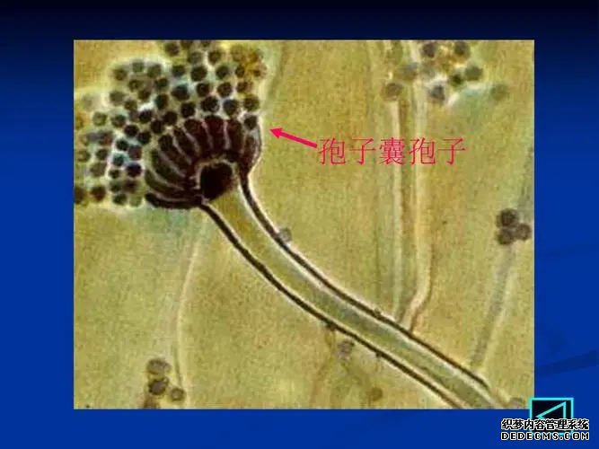 新生儿鼻子发青怎么回事,是正常情况吗