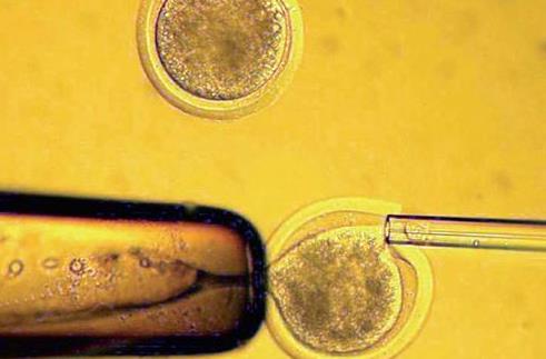 做试管婴儿能一次要龙凤胎吗 