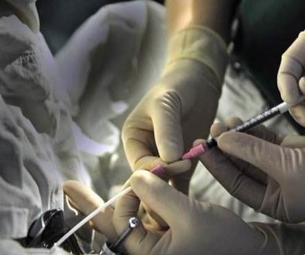 山东试管权威 山东正规生殖医院做供精人工授精要排队吗？ ‘5-6周b超如何看男孩女孩’