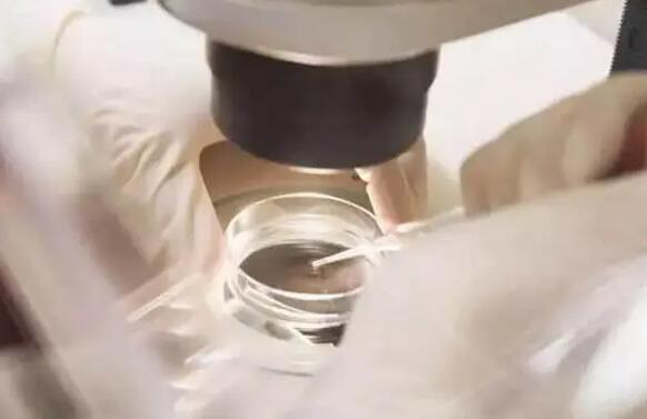 上海做试管供卵 2023年上海和平妇婴医院能做供卵三代试管包生男孩吗 ‘孕妇初期梦到小女孩还有鱼是什么征兆’