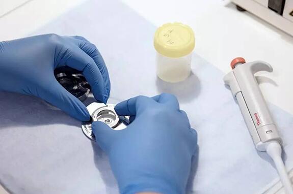 长春试管供卵 长春吉大二院宫腔镜检查多少费用？价格贵不贵？ ‘3个月彩超怎么看男孩女孩三个月的彩超’