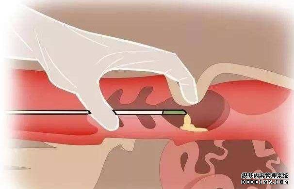 杭州地下代孕点 杭州邵逸夫医院就诊指南分享 ‘9个最准怀女孩征兆有哪些’