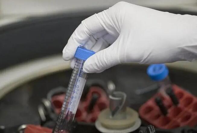 广州哪能做供精试管 广州中山孙逸医院试管价钱试管婴儿的钱花在哪？ ‘阴道三维彩超怎样鉴别男女’