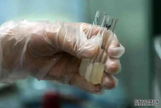 福州代孕在哪里 影响福州试管费用的因素： ‘双顶径93股骨长78是男是女呢’