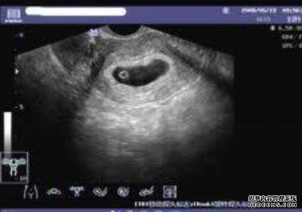 无锡借卵子生子的过程 2无锡101医院做试管成功率能达到多少? ‘代孕9周怀男孩彩超图’