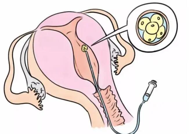 大连三代试管 大连妇幼儿童医院试管婴儿怎么样？ ‘363212的孕囊生男孩还是女孩’