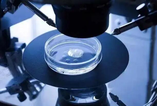 山西供卵试管 2023山西供卵试管不要排队的医院有哪些? ‘胎儿男女生殖器b超图像’