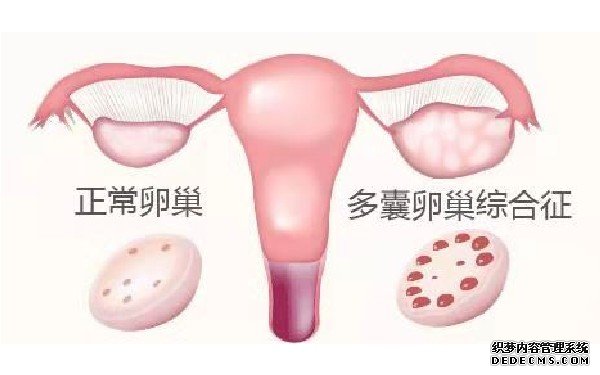 广州借卵自怀流程 广州中山孙逸医院试管价钱？你知道试管婴儿的费用在哪儿吗？ ‘双顶径46mm股骨长32mm是男孩还是女孩’