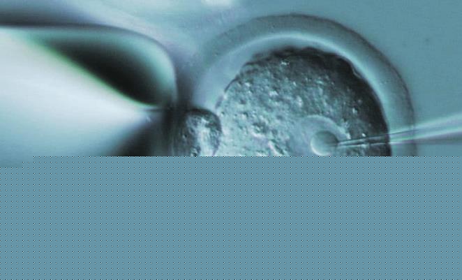 深圳供卵试管群 深圳市妇幼保健院哪个试管婴儿医生技术好 ‘网上看四维单子看男女’