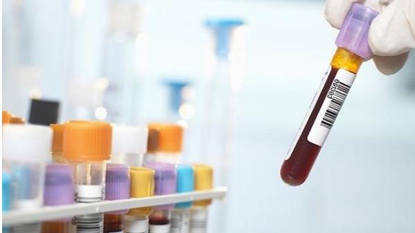 泰国试管婴儿医院流程，取卵和取精需要在同一天进行吗？