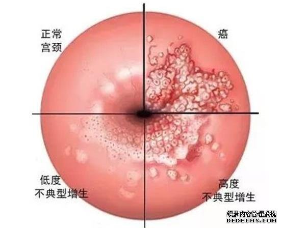 山西代孕qq 山西省生殖遗传医院试管咋样?试管费用要多少? ‘7个月酒精测男女