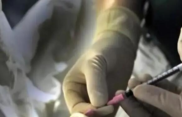 盐城供卵试管 盐城试管婴儿医院选择经验 ‘37天孕囊大小两个是男还是女?’