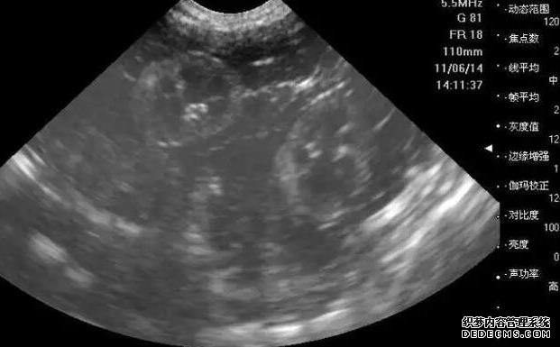 ?？诖新厶?2022年?？谟?家试管医院能包生男孩，内附助孕的3个条件限制 ‘四维5.7:20.8:17.9是男是女’
