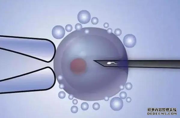 广西代孕有保障吗 广西壮族自治区妇幼保健院 ‘胎儿双顶径头臀径怎么看是男孩’