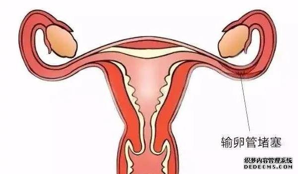 试管进周为什么要选择在经期的第二天？这样做有什么讲究吗？