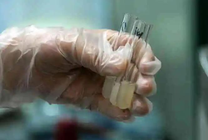 郑州试管补贴 郑州第二附属医院试管婴儿需要多少钱？怎样才能减少花销？ ‘孕囊1.8以下看男女’