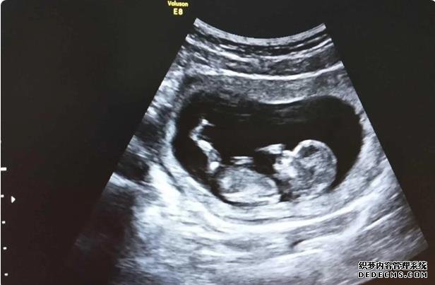 苏州试管供卵自怀费用 2022苏州助孕指南：苏州哪个医院做试管比较好？ ‘只有四维能看出男女吗’