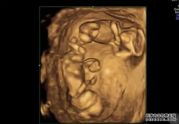 生化妊娠不会影响女性的生育能力，隔月怀孕的例子也有很多