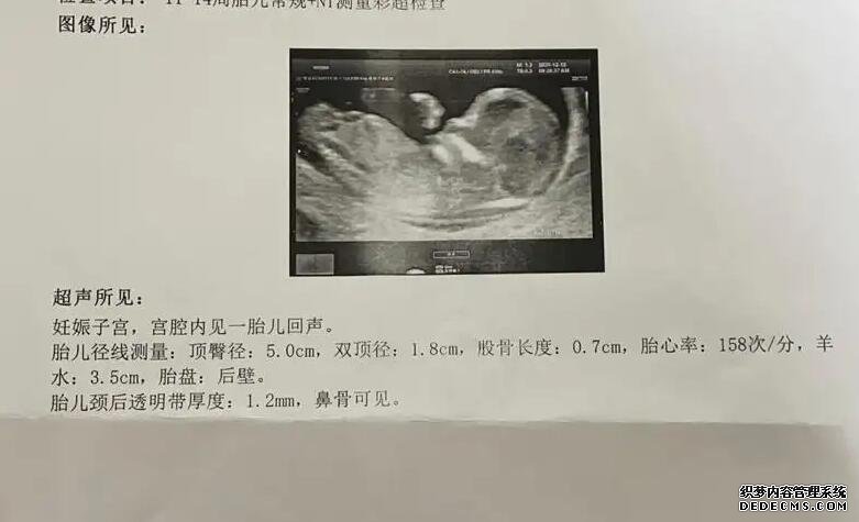 厦门包男孩 在厦门174医院做试管流程和费用 ‘怀孕31周b超看男女准吗’