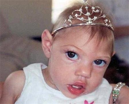 夏日孕妇饮食需注意：夏天吃什么水果？