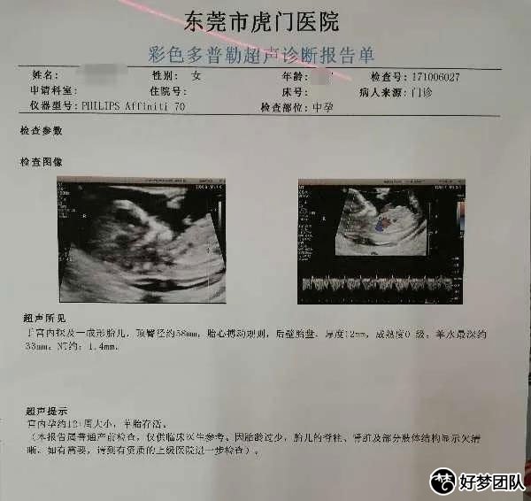 多囊月经不调难怀孕