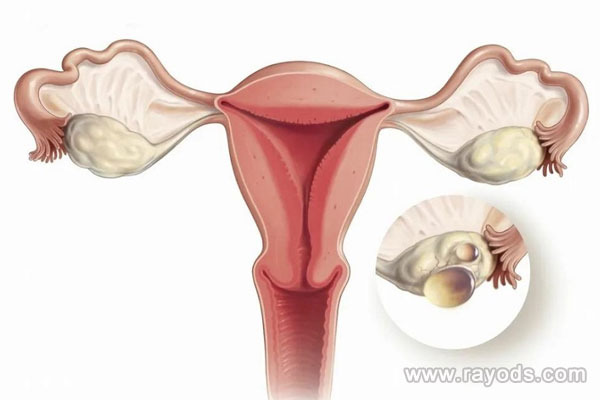 三代试管咨询,供卵助孕