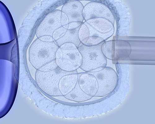 高龄做试管，这些经验能帮你