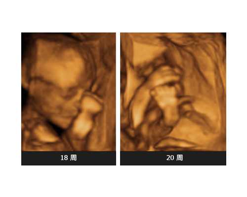 潮州市中心医院人工授精指南