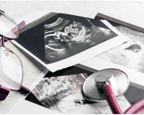 孕早期孕酮多少算正常，孕酮是什么