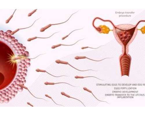 弓形子宫做试管怀双胞胎的条件和真实故事