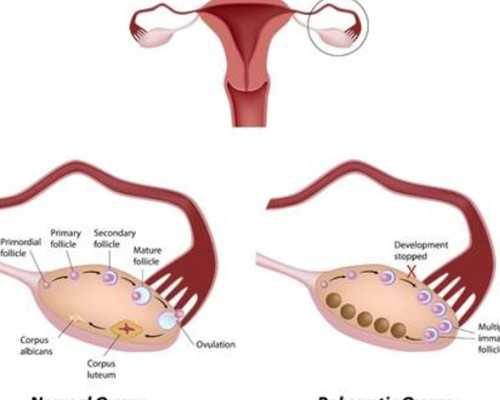 严重少精弱精做试管，成功率会怎样