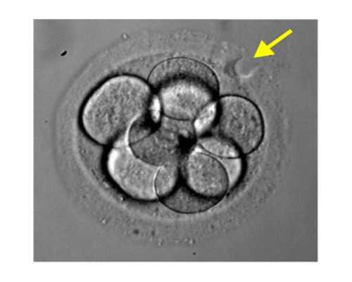 广州助孕公司怎么??？这些优势值得了解