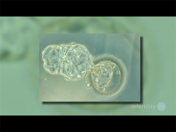 2026年海外试管婴儿全攻略：从准备到流程，一步到位