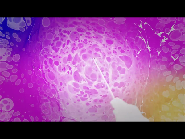 7次试管未如愿？34岁女性必看的失败根源与高效应对方案