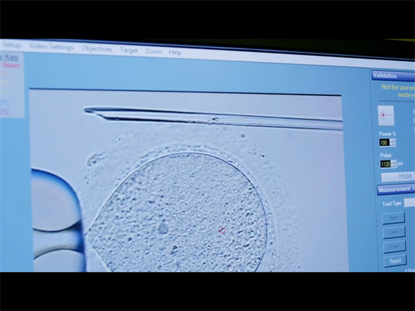 试管移植当天胚胎意外滑落？别慌，科学应对方案全解析